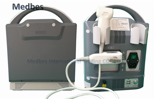 Ultrasonic Diagnostic Automatic Portable Ultrasound Bone Densitometer