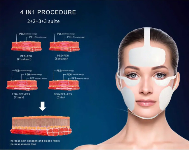 EMS EMT RF 3 In 1 Machine for Face Muscle Stimulate Muscle Sculpting Wrinkle Removal Skin Tightening