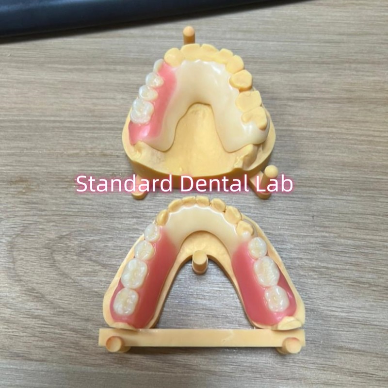 Esthetic Tooth Shade Acetal Framework Tooth Coloured Clasps Ivoclar Set Up