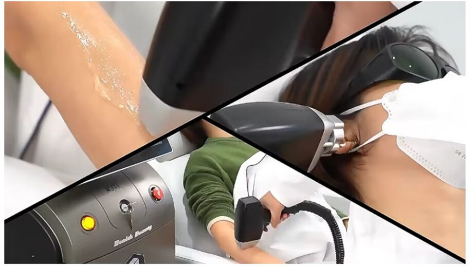 Powerful New 808nm Ice Diodo Trio 3 Wave Diode Laser 810nm Depilation 808 Nm Hair Removal 3 Waves Titanium Medical Machi