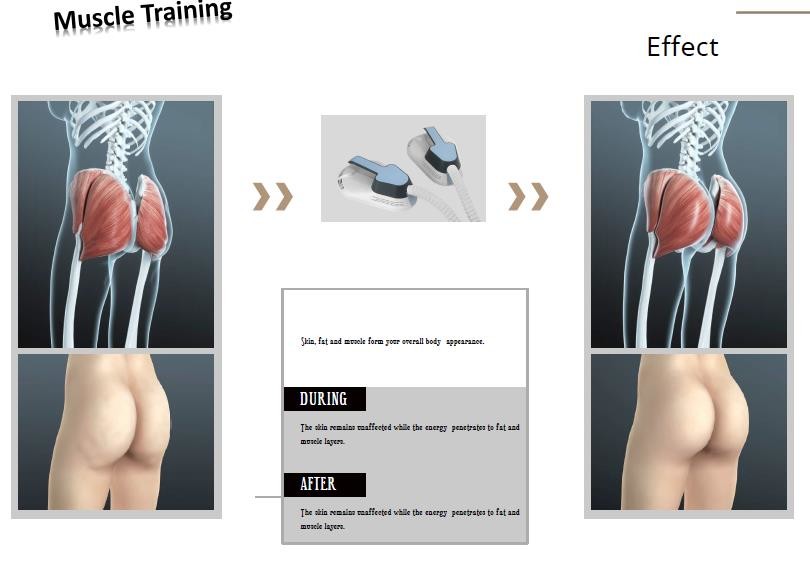 Lasertell ODM Ems Muscle Stimulator Machine