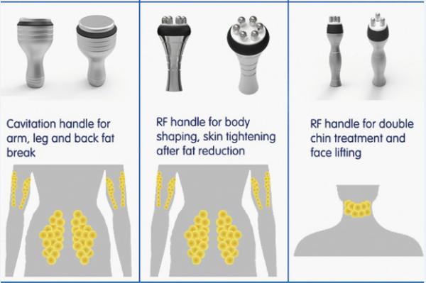 80% clinic used Promotion 5 handles (Crolipolisis+RF+vacuum+cavitation)