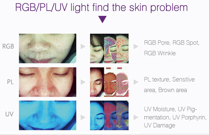 Portable Skin Analyzer Machine , Beauty Skin Testing Analysis Machine