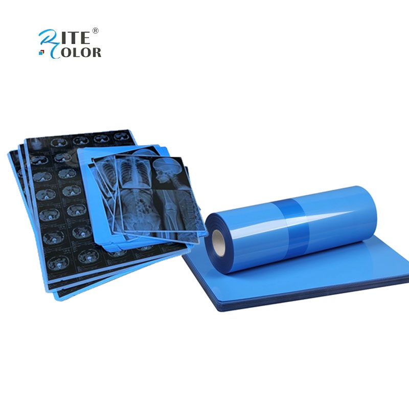 210mic Inkjet Printing X Ray Blue Medical Imaging Film In A4 8"X10" Sheets