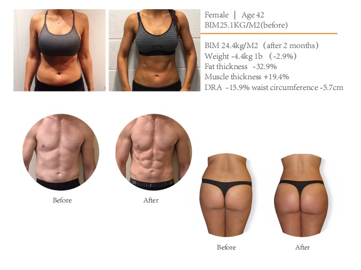 Aesthetic Machine For Fat Loss Muscle Building EMS Machine