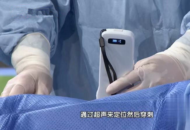 5G Wifi Handheld Ultrasound Scanner Pocket Ultrasound Built - in 4200mAh Lithium Battery Wireless Charger Supported 0