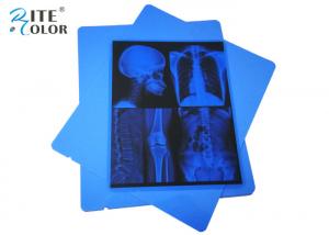 China 13 X 17 Inch Medical Imaging Film PET Blue Inkjet Xray Radiology on sale