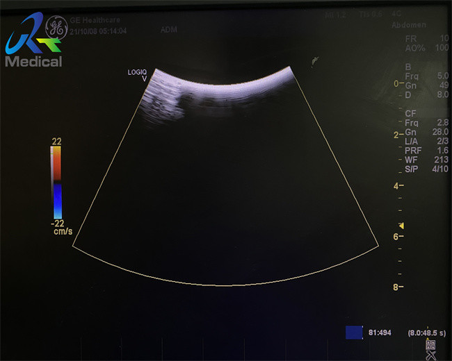 GE 4C-RS Ultrasound Probe Repair Crystal Replacement Imagine Problem