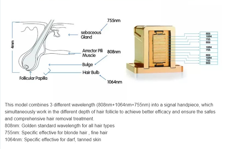 755nm 808nm 1064nm diode laser body hair removal machine 1200W