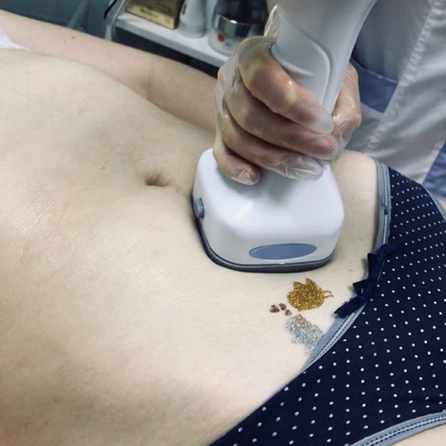 Cavitation Rf Slimming Machine