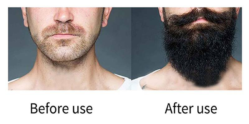 Organic Beard Hair Growth Serum 30ml Facial Hair Growth Serum