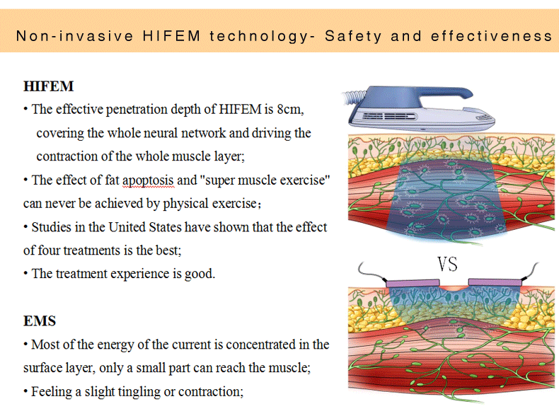 1mhz Ems Infrared Ultrasonic Slimming Machine
