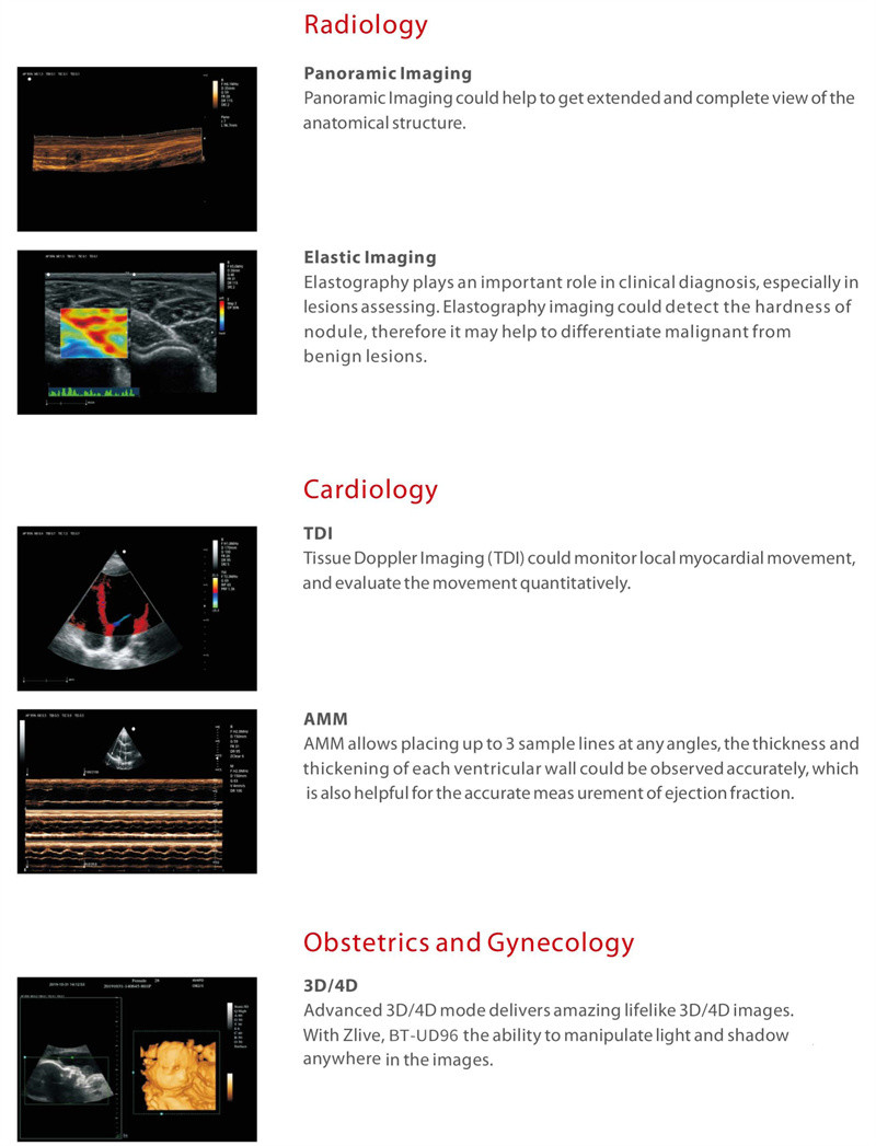 Portable 4D Ultrasound Machine Medical Data Interface Video VGA DICOM3.0 USB Printer Port