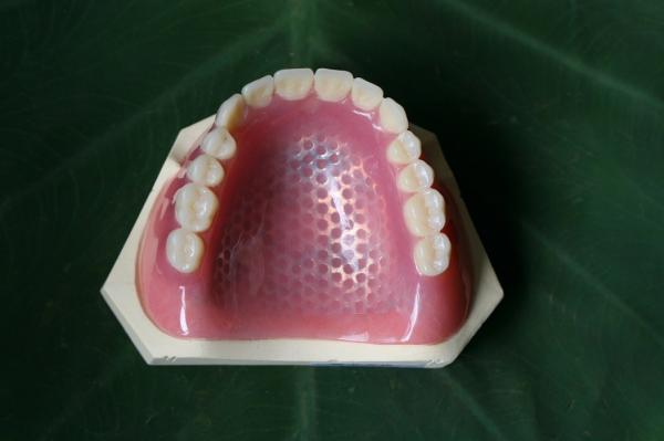Quality ISO13485 Conventional Denture Upper Acrylic Partial for sale