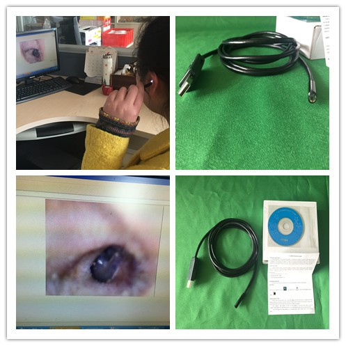 BM4 USB Otoscope.jpg