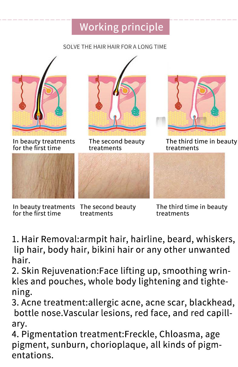 Skin Tightening Optical Ipl Hair Removal Machine 610nm Multi Pulse