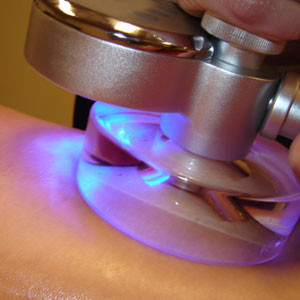 Lipo Cavitation Ultrasonic Fat Reduction Machine / Cellulite Removal Machine For Body Slimming