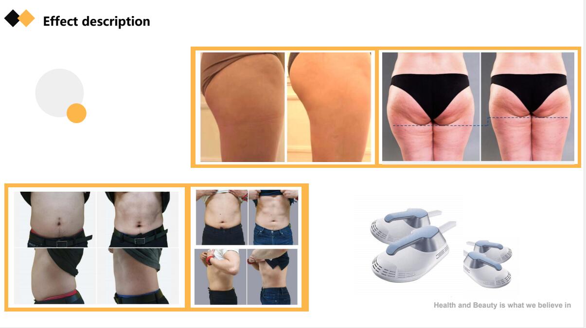Professional EMS Slimming Machine 5000W With Electrical Muscle Stimulation