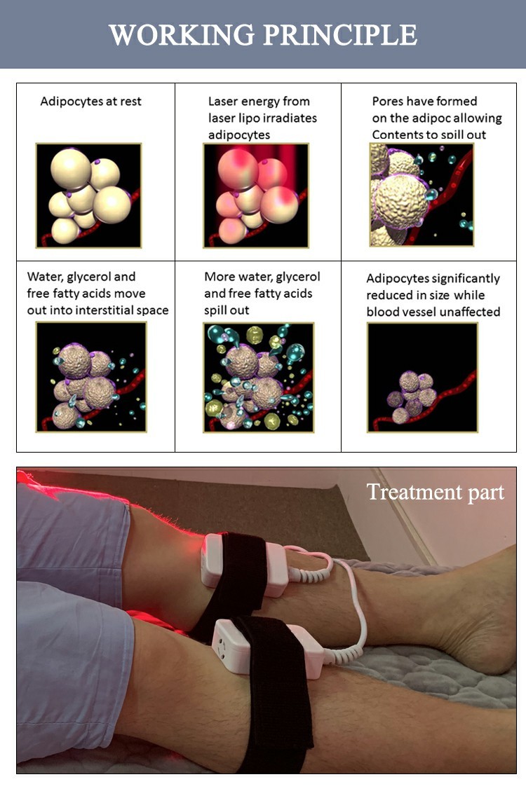 OEM Diode Laser Slimming Machine / Anti Aging Non Invasive Lipo Machine