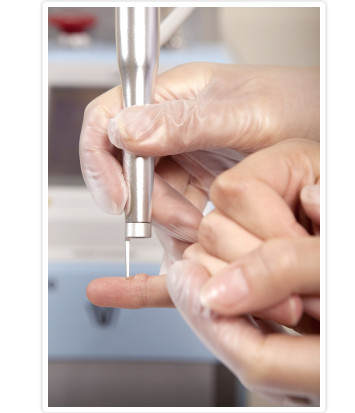 Skin Warts Removal Fractional CO2 Laser / Vaginal Tightening Machine CE Certificate