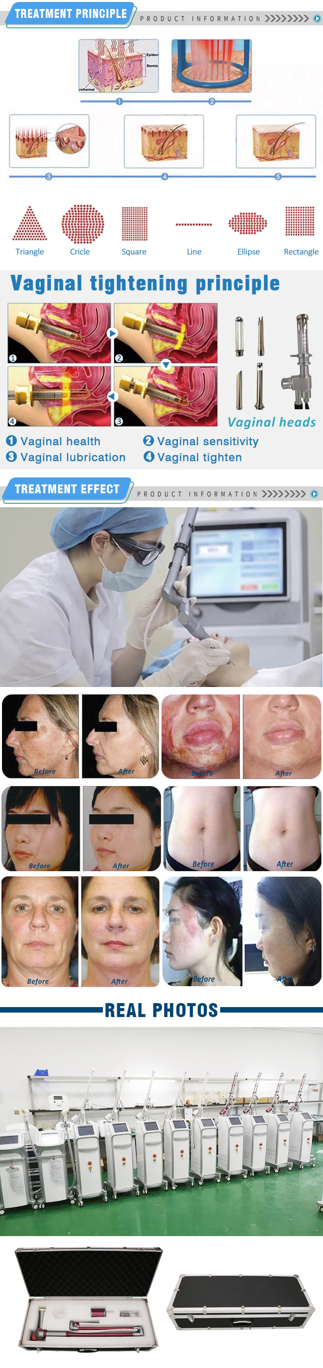 40w Co2 Laser Machine For Skin , Fractional Laser Machine