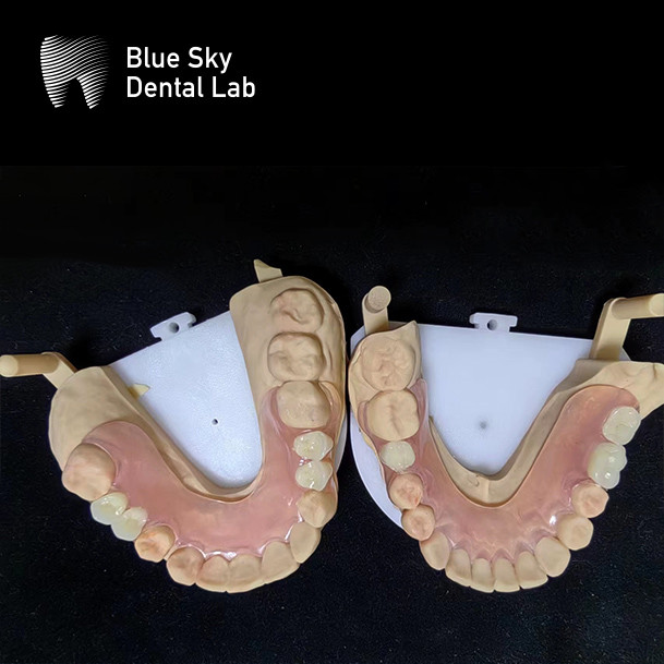 Full Arch Removable Acrylic Denture Customizable Natural Looking Denture