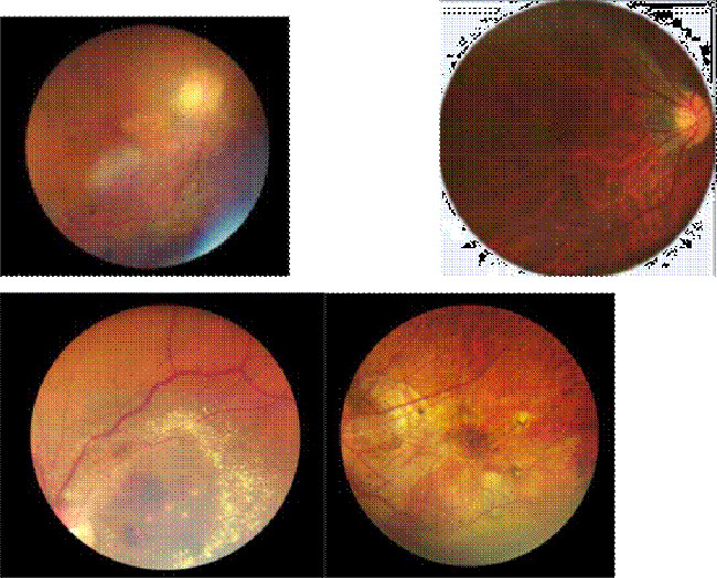New Ophthalmology Device Portable Hand-held Fundus Camera High definition Image