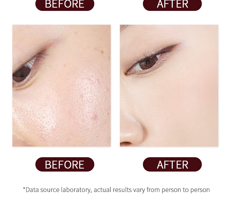 Skin Care Deep Clean Body Lotion Essens Hydrating Nourish Whitening Hyperpigmentation Treatment Skin Care