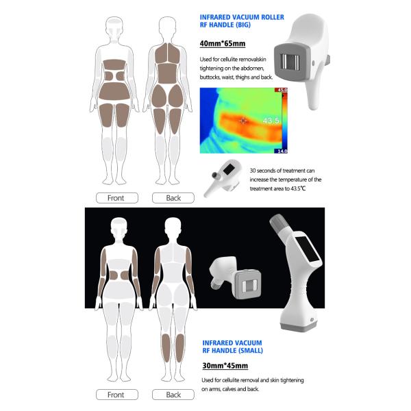 GOMECY VelaBody RF Vacuum Roller Therapy Body Sculpting RF Skin Tightening Vacuum Cellulite Reudction Cavitation Body Contouring Laser Body Slim Machine