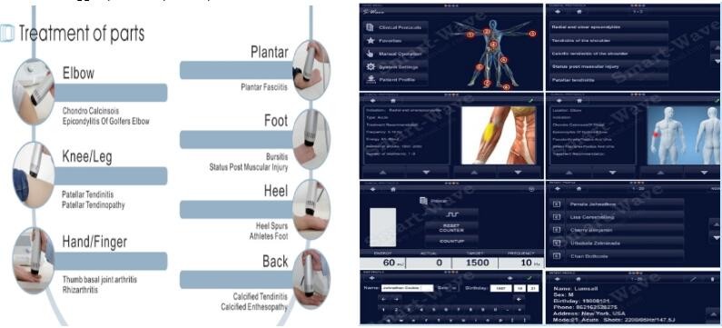 22 Hz Acoustic Wave Shockwave Therapy Equipment For Pain Relief / Improve Blood Circulation
