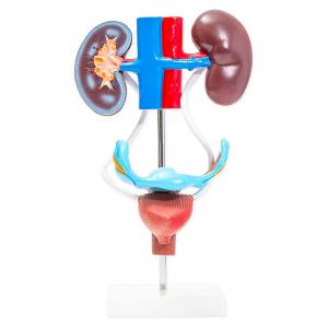 China Pvc 23cm Human Anatomy Model Female Genitourinary Reproductive System on sale