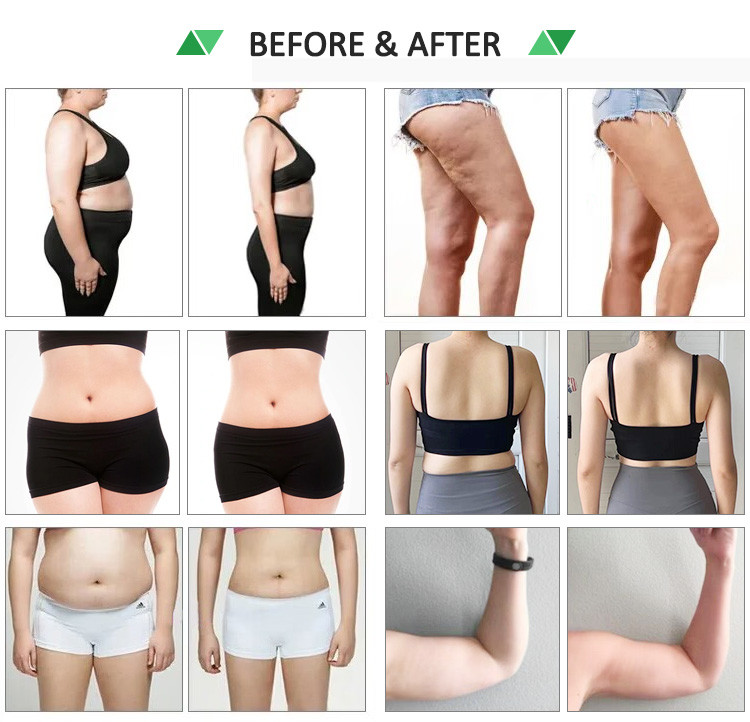 10D Maxlipo Master Laser Slimming Machine For Improves Skin Elasticity / Weight Loss