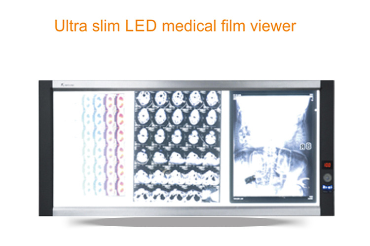 LED x-ray film viewerled medical film viewer