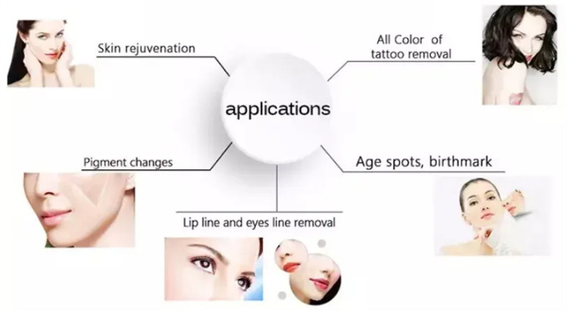 Big Power Small Case Nd Yag Laser Tattoo Removal Pigment Removal Device