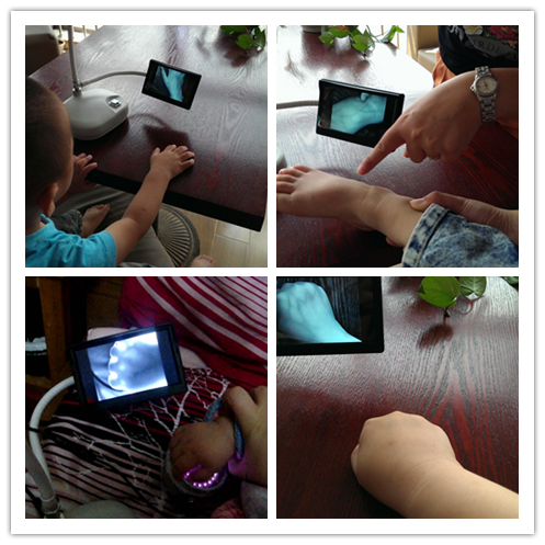 Portable Venipuncture device Vein Locator