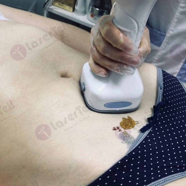 Rf Body Vacuum Cavitation Slimming Machine For Fat Removal