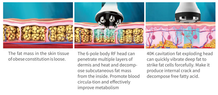 40K Cavitation Weight Loss Machine 40KHz Cavitation RF Vacuum Slimming Machine