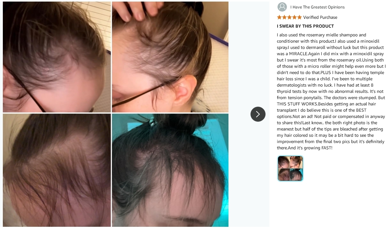 Biotin Enriched Rosemary Mint Hair Regrowth Shampoos Deep Cleansing for Fragile Damaged Hair