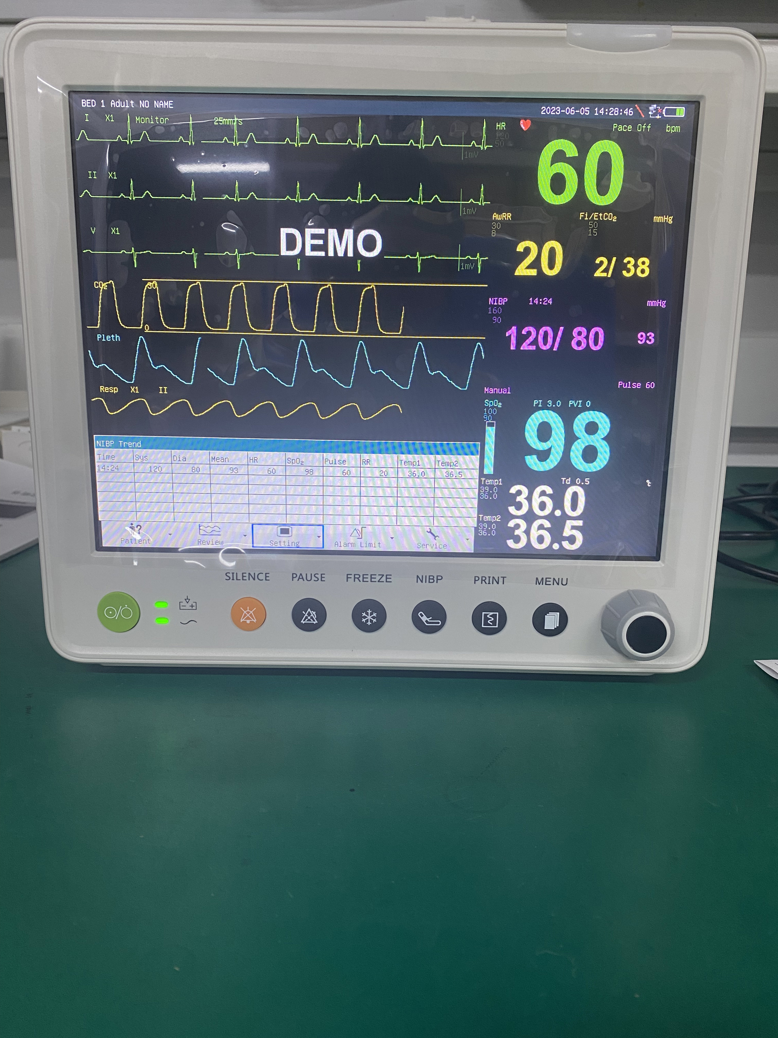 Portable Patient Monitor With Parameters Of ETCO2 ECG NIBP SPO2 RESP TEMP PR