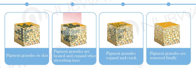 CE approved effective Body Tattoo,Eye line and brow Tattoo removal laser equipment