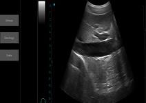 Ultrasound Scan Equipment Portable Ultrasound Scanner Palm Ipad Ultrasound Machine