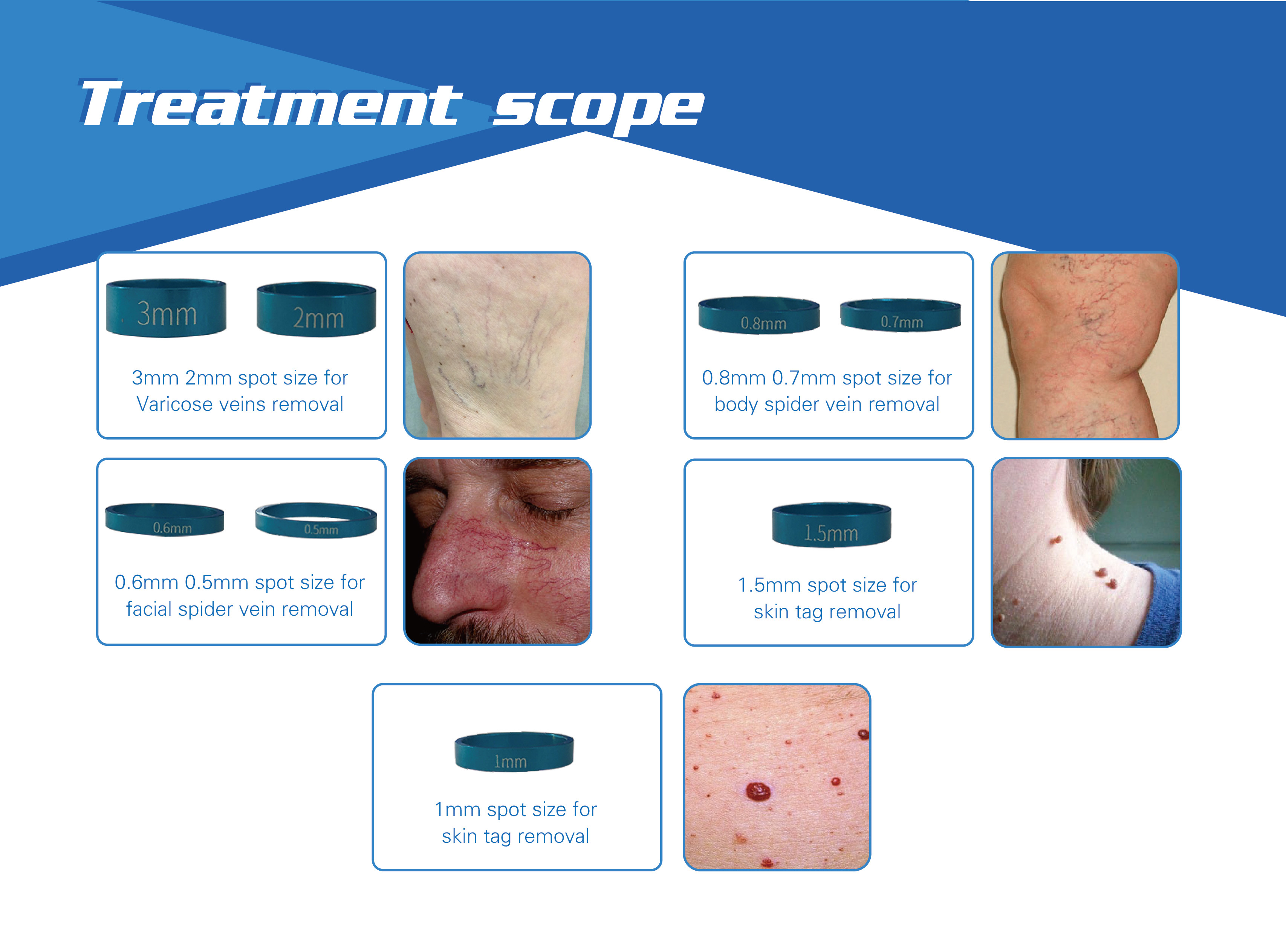 980nm diode laser 30w therapy laser spider vein removal machine