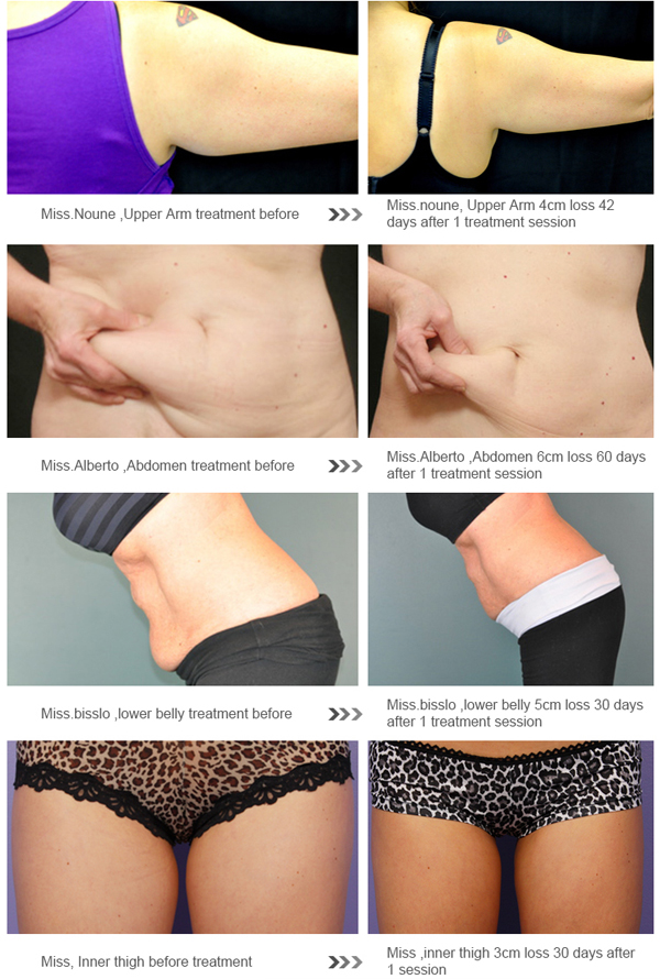 air pressure body slimming suit body cryolipolysis slimming massager beauty equipement