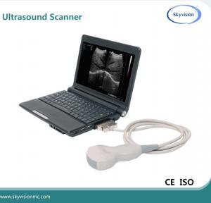 China veterinary ultrasound/dog pregnant ultrasound scanner on sale