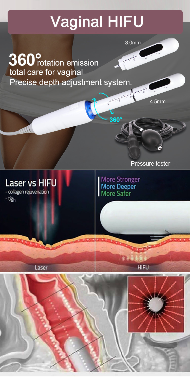 Facial And Body Contouring With High-Energy Focused Ultrasound HIFU Machine