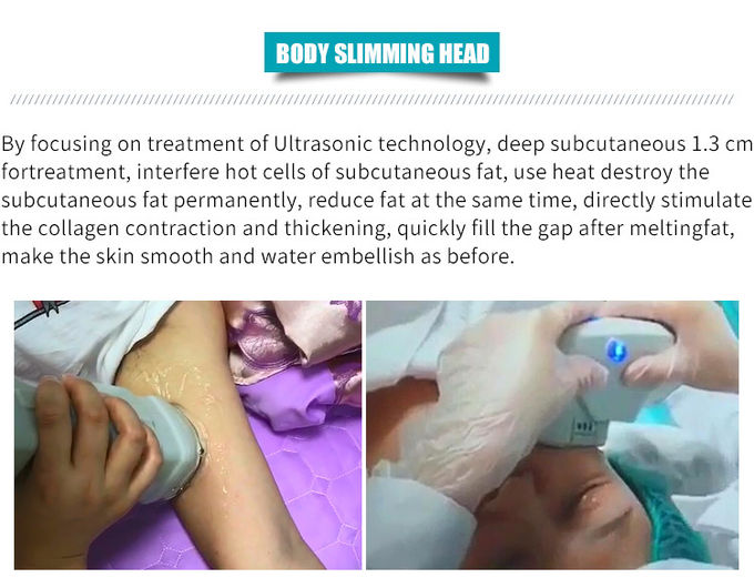 300W 4D High Intensity Focused Ultrasound Facelift Machine