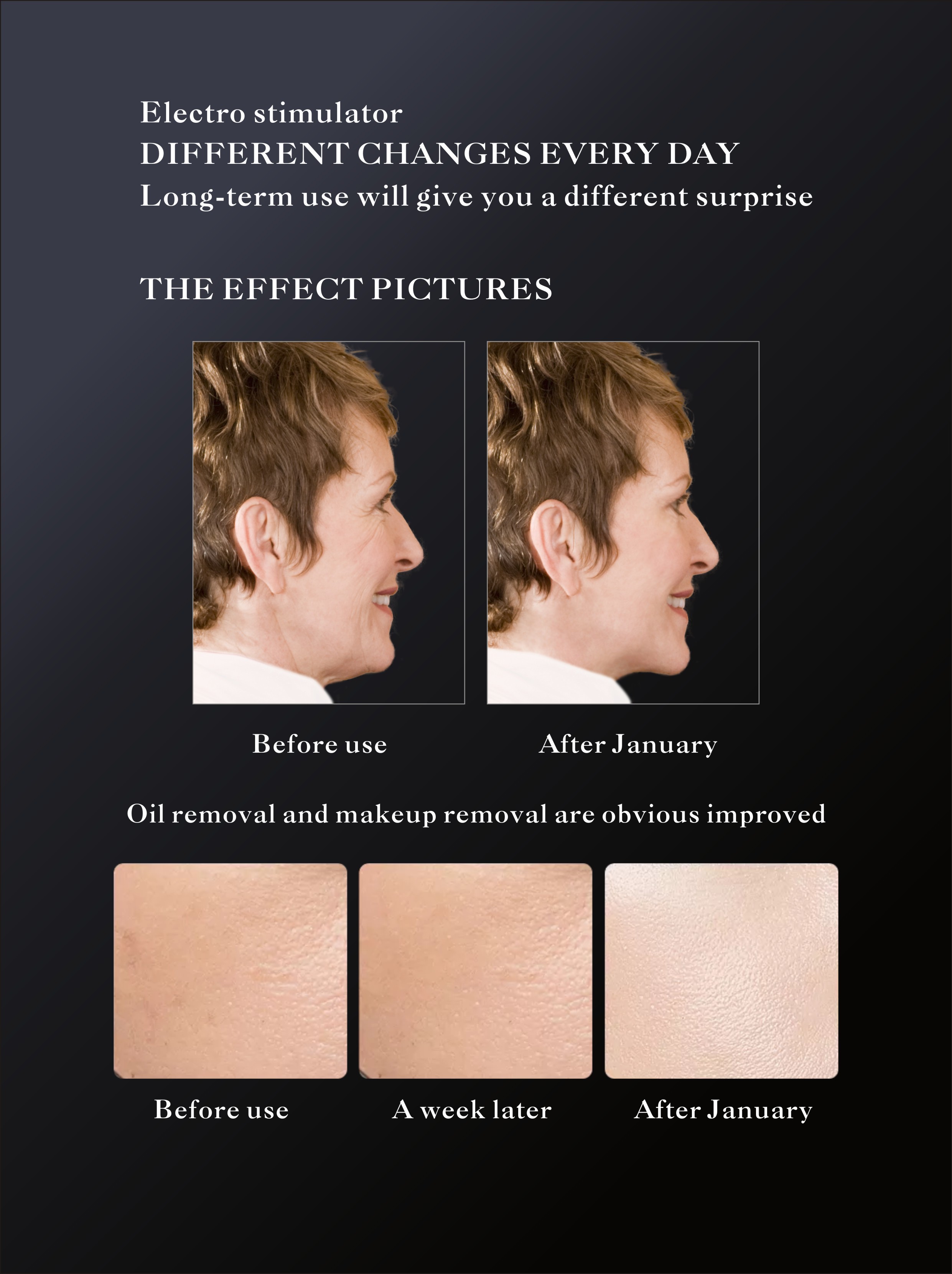 Commercial Non Invasive Skin Rejuvenation Machine , Stand Alone Skin Tightening Machine