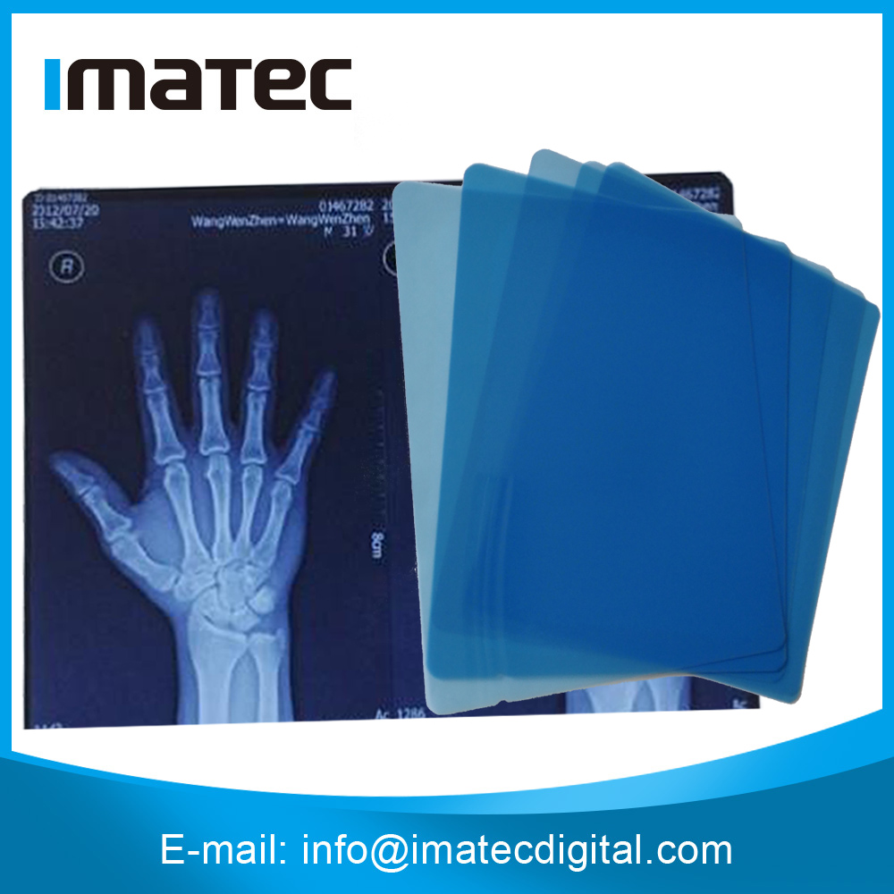 210 Micron Thickness Blue Sensitive Film X Ray Image For Inkjet Dry PET Printing A4