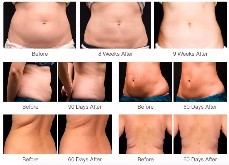 2021 New Arrival 6 In 1 40K Cavitation Vacuum Radio Laser Massager lipo Laser Slimming Machine