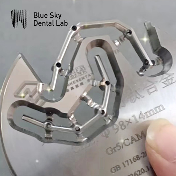 Full Upper And Lower Titanium Bar Blue Sky Dental Implants